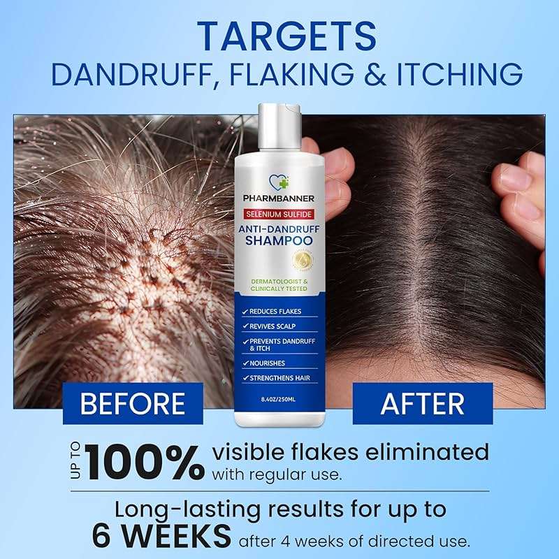 PHARMBANNER Anti-Dandruff Shampoo with Selenium Sulfide: For Flaky Scalp, Itching & Seborrheic Dermatitis Relief - Menthol & Lavender Oil - Moisturizing, Color Safe, Gentle for All Hair Types | For Flaky Scalp - Image 2