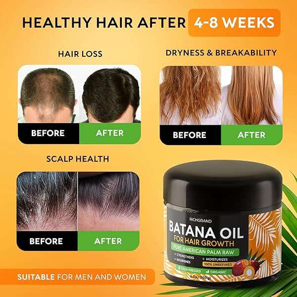 RICHGRAND Batana Oil for Hair Growth & Skin - 100% Raw Unrefined Batana Butter from Honduras - Multipurpose Body Moisturizer - Natural Cold Pressed Oil for Scalp, Split Ends & Dryness (5.3 oz) - Image 3