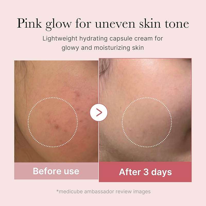 medicube Capsule Cream with Salmon DNA PDRN Pink Collagen | Lightweight Moisturizing Cream with PDRN, Niacinamide for Uneven Skin Tone and Texture, Glow hydration | Korean Skincare, 1.94 oz - Image 4