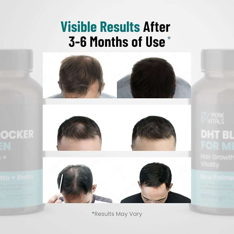 DHT Blocker for Men | Ultra Potent Hair Growth Formula | Saw Palmetto, Biotin, Pumpkin Seed, Herbal Extracts | Natural Hair Loss Supplements | Hair Regrowth Vitamins | Made in the USA | 90 Capsules - Image 7