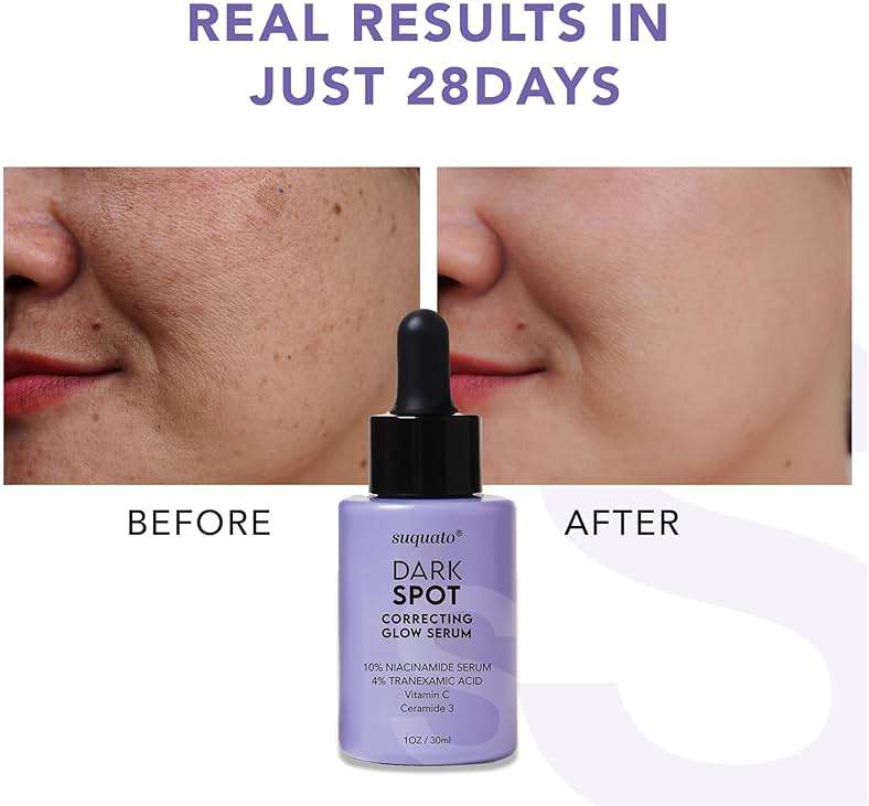 suquato Dark Spot Remover Serum – For Face Hyperpigmentation & Melasma Care – Dark Spot Correcting Glow with Tranexamic Acid + Niacinamide + Vitamin C (30ml) - Image 4