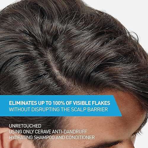 CeraVe Hydrating Anti Dandruff Shampoo, 1% Pyrithione Zinc Dandruff Treatment With Ceramides, Niacinamide & Hyaluronic Acid, Helps Eliminate Flakes & Provides Itchy Scalp Relief, Sulfate Free, 12 Oz - Image 3