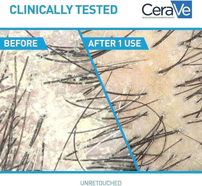 CeraVe Hydrating Anti Dandruff Shampoo, 1% Pyrithione Zinc Dandruff Treatment With Ceramides, Niacinamide & Hyaluronic Acid, Helps Eliminate Flakes & Provides Itchy Scalp Relief, Sulfate Free, 12 Oz - Image 4