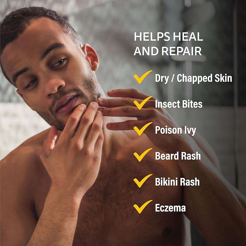 A+D Medicated Rash Ointment 1.5 oz– Relieves Rash & Skin Irritated Skin from Poison Ivy, Eczema, Beard, Bikini, Dry Skin, Chapped Skin, bug bites. Made with Colloidal Oatmeal - Image 8