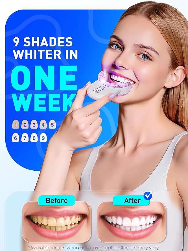 Teeth Whitening Kit for Sensitive Tooth: Professional Whitening Gel Pens Strips Dental kit, 32X LED Light White Personal Care Products, 35% Carbamide Peroxide Whitener, Beauty Tools for Home - Image 2