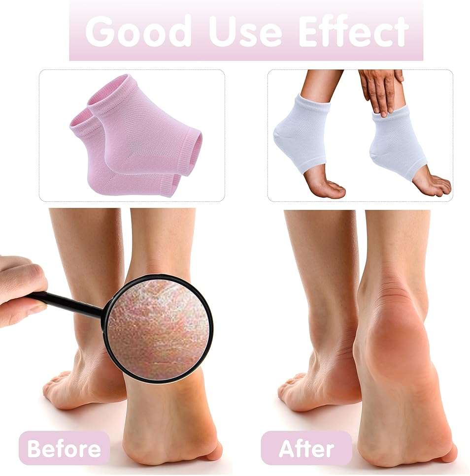 2 Pairs Moisturizing Heel Socks for Dry Cracked Feet, Gel Repair Moisture Spa Socks Foot Care Lotion Socks for Women Cracked Heel & Dry Foot Treatment Overnight - Image 2