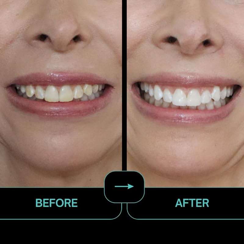 IntelliWHiTE ProStrips Teeth Whitening Strips, 28 Day Treatment, Whitens Up to 12 Shades, Enamel-Safe Gentle Remineralizing Formula, Dentist Formulated for Sensitive Teeth, (56pk Mint Flavor) - Image 3