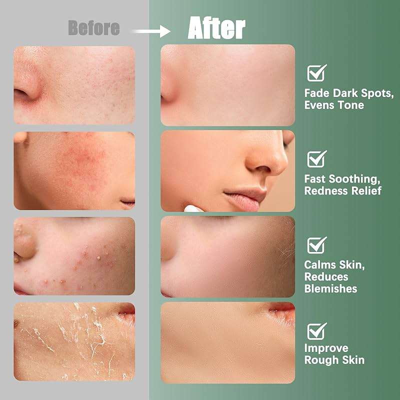 Kestper Madecassoside & Caffeine Toner Pads|Soothe Redness,Strengthen Barrier & Refine Pores with Centella Asiatica,Niacinamide | 110 Pads for All Skin Types - Image 4