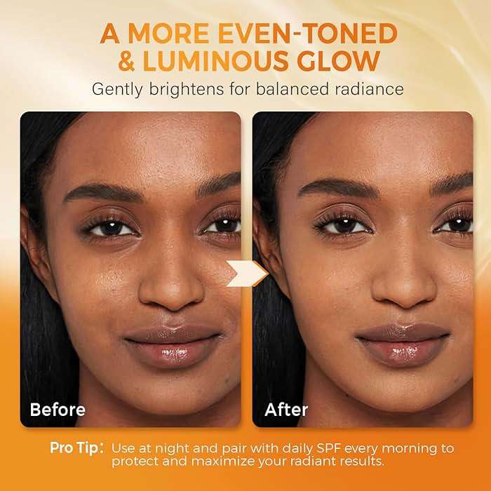 QOOQ Turmeric Kojic Acid Soap for Dark Spots Remover – Facial Cleansing Bar with Vitamin C, Retinol, Collagen, Vitamin E, Glycerin, Shea Butter & Castile Olive Oil – Soap for Women & Men (120g x 2) - Image 3