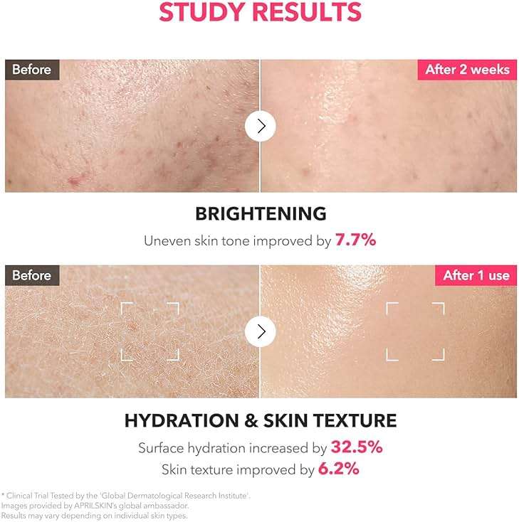APRILSKIN TXA+Niacinamide 99 Pink Milky Toner | 99% High-Purity TXA 3%+ Niacinamide 5% for Brightening | Highly Concentrated Cream Toner | Deep Moisturizing Formula for Dull Skin | 5.07 fl.oz. - Image 5