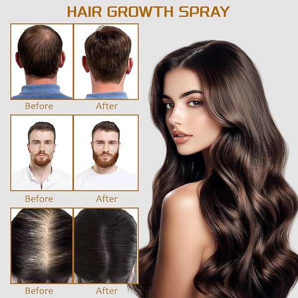 100ml 5% Minoxidil Spray with Biotin - Regrowth Treatment for Men & Women, Promotes Thicker, Stronger, Fuller Hair, Prevents Hair Loss, Minoxidil for Men Hair & Beard, Minoxidil for Women Hair Growth - Image 4