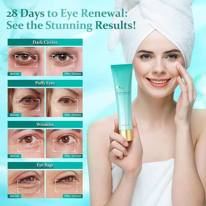 HOLYOM Eye Cream for Dark Circles & Puffiness Reduces Eye Bags, Wrinkles & Fine Lines | Hydrating Under Eye Care for Women - Image 3