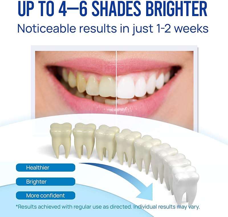 Teeth Whitening Pen Gel Kit, 35% Carbamide Peroxide Gel for Stain Removal, No Sensitivity, Remineralizing Pen, Brighter Smile in 2 Weeks, Mint Flavor, 5 Pack - Image 2