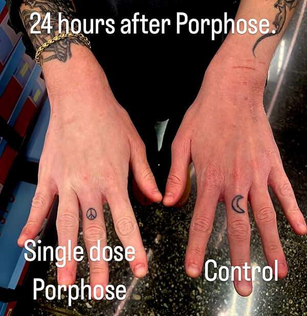 Porphose Eczema Relief Spray for Kids and Adults | OTC Skin Protectant with Red Algae + Colloidal Oatmeal | Steroid-Free, Fragrance-Free, Pediatrician-Tested | 1 fl oz - Image 2