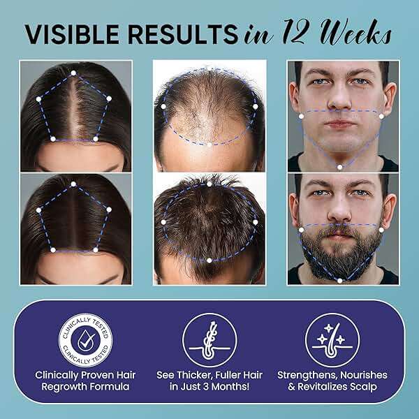 Olivita Hair Growth Spray for Men and Women - Image 3