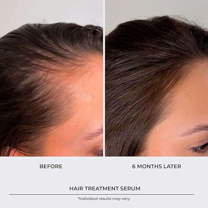 Hair Growth Serum & Thickening Serum With Biotin & Rosemary Oil, Multi-Benefit Treatment for Thinning Hair, Boosts Density, Strengthen, Hydrate, Nourish and Repair Dry Scalp for Men & Women, 1 Pack - Image 2
