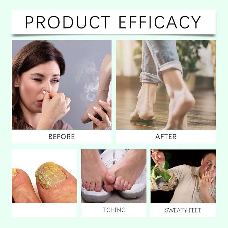 2Pcs Ximonth Foot Spray with Tea Tree Oil,Tea Tree Oil Feet Spray,TeaTree OilSpray for Foot (100ml/3.38fl.oz) - Image 7