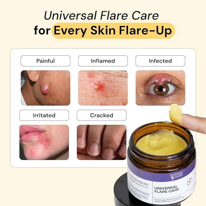 MyMagicHealer Universal Flare Care – Solution for Everyday Skin Flare-Ups | Drawing Salve for Boils & Cysts, Hidradenitis Suppurativa, Folliculitis | Irritated Skin and Chafing Relief 1 oz - Image 2