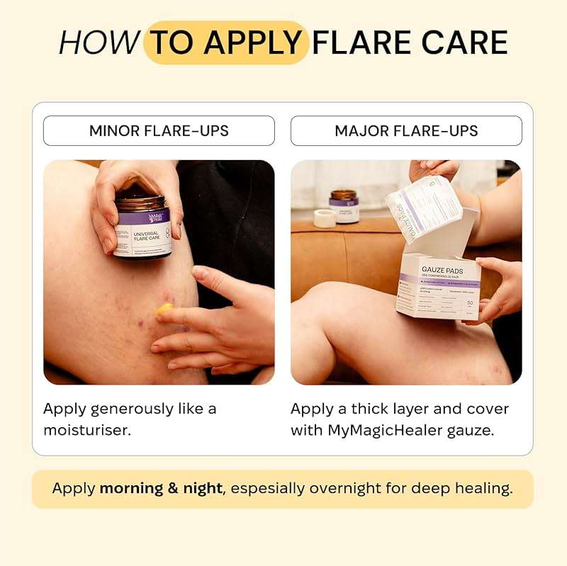 MyMagicHealer Universal Flare Care – Solution for Everyday Skin Flare-Ups | Drawing Salve for Boils & Cysts, Hidradenitis Suppurativa, Folliculitis | Irritated Skin and Chafing Relief 1 oz - Image 7