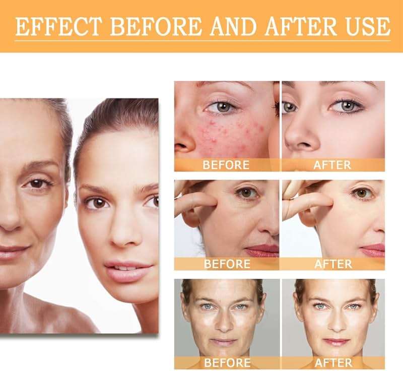 7% Glycolic Acid Exfoliating Toner, Gentle Exfoliating Toner, Smooth Skin, Restores Skin Vitality and Refreshing, Hydrating Formula, Pore Minimizer-240ml/8.44 fl.oz. - Image 4