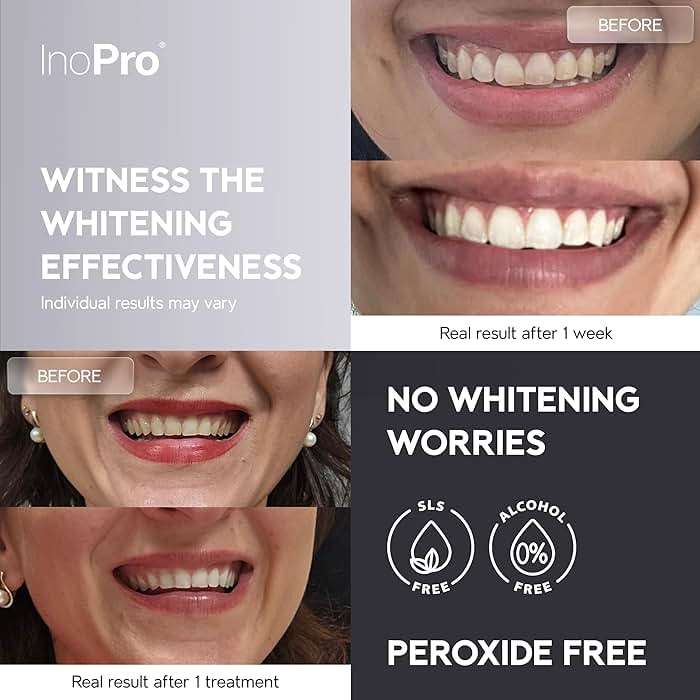 InoPro Natural Teeth Whitening Strips Kit 21 Treatments - Sensitive Teeth Whitener, Peroxide Free with Papain, Bromelain, Coconut Oil, White Strips for Teeth Whitening (42 Strips) - Image 2