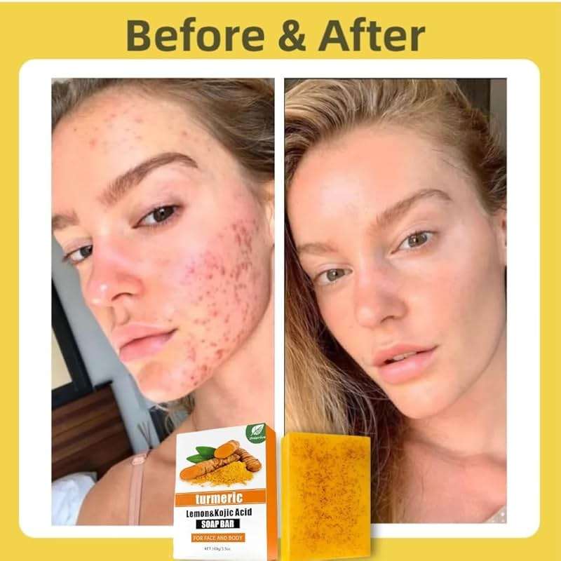 Uselective Lemon & Turmeric Soap Bar for Dark Spots, Powered by Kojic Acid & Vitamin C - Deeply Moisturizing with Amino Acids & Shea Butter - SLS Free for Face/Body - Image 4