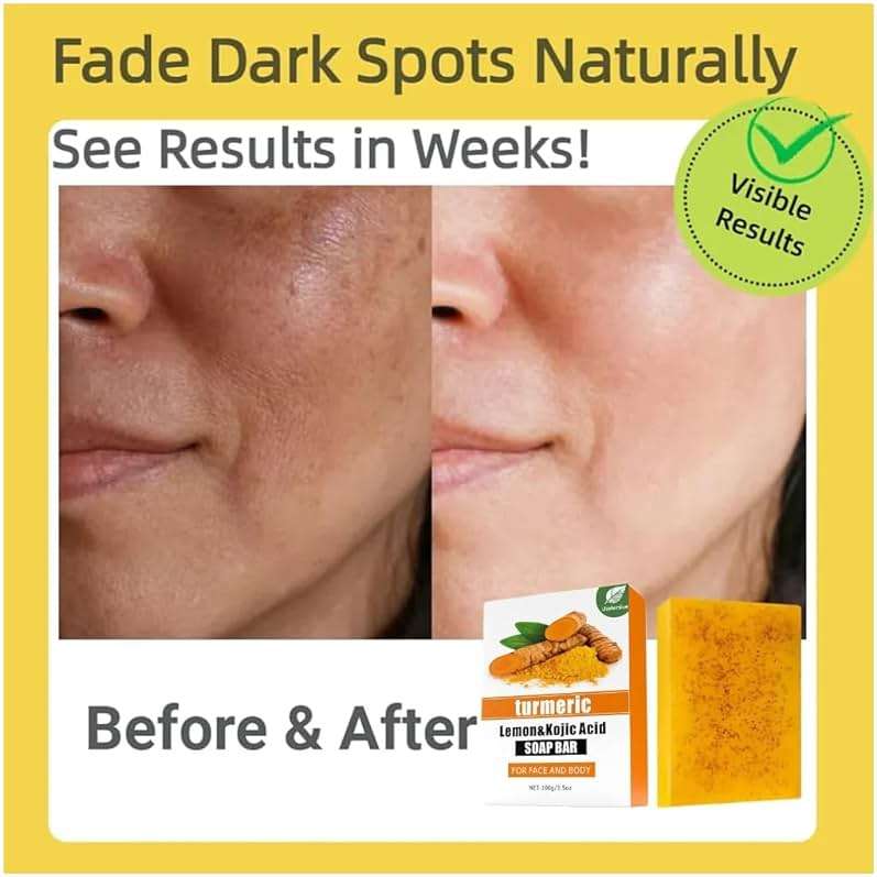 Uselective Lemon & Turmeric Soap Bar for Dark Spots, Powered by Kojic Acid & Vitamin C - Deeply Moisturizing with Amino Acids & Shea Butter - SLS Free for Face/Body - Image 6