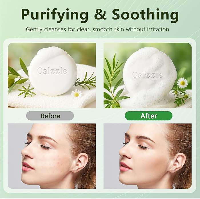 Calzzle 4 Pcs Herbal Soap Bar with Tea Tree Oil, Olive Oil & Organic Shea Butter - Natural Handmade Soap for Women & Men, Gentle Face, Body & Foot Cleanser for Dry, Itchy or Sensitive Skin, 3.53 oz - Image 4