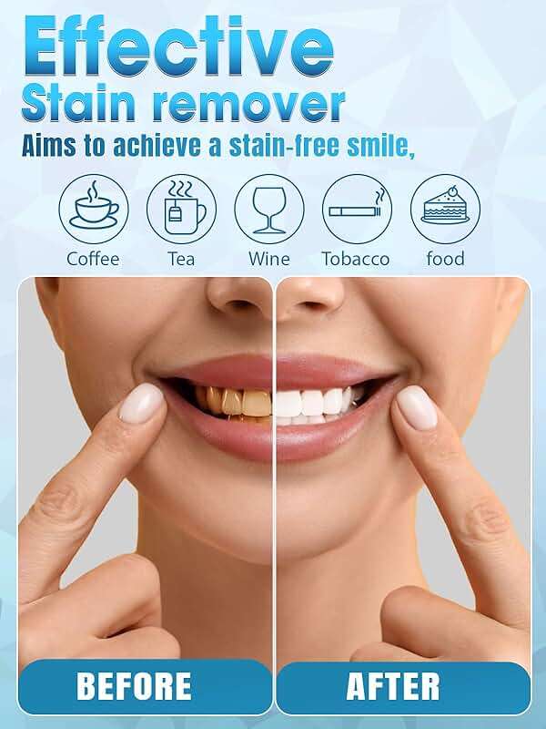 Teeth Whitening Kit with LED Light - White Sensitive Tooth 35% Carbamide Peroxide Gel Pen Dental Mouth Trays Whitener Professional Bright Brace Product System for Home Work Travel - Image 6