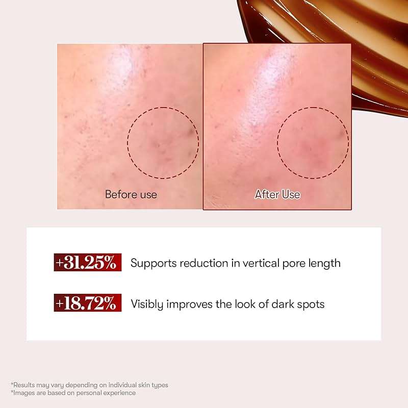 VT COSMETICS Red Booster Reedle Shot 100 Serum with Dragon’s Blood Extract & Exosome Microneedling Formula, Korean Skincare, 1.69 fl oz(50ml) - Image 4