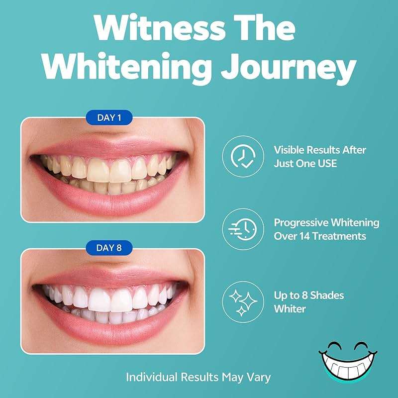 SmileFreshness Teeth Whitening Strips, 14-Day Treatments Clinically Proven for Visible & Affordable Teeth Whitening, Enamel Care Whitening, Reduced Sensitivity Formula, Coconut. - Image 3