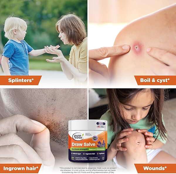 Pure Ease Drawing Salve Ointment 2oz - Image 2