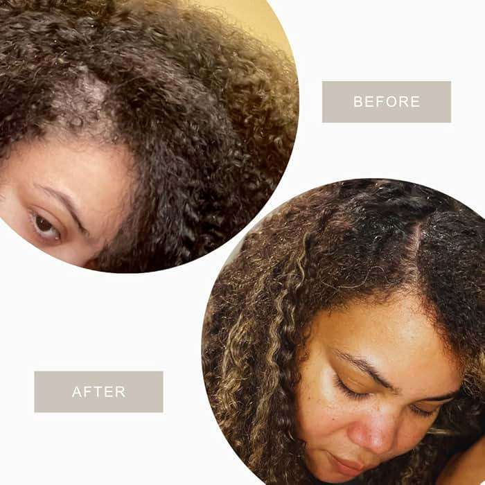 Hair & Scalp Serum for Growth & Strength. Herbal Oil Infusion with Plant based Amino Acids, Rosemary, Nettle, Fenugreek. Strengthens Roots + Supports Healthy Scalp (1oz) - Root Renew by Botanbee - Image 2