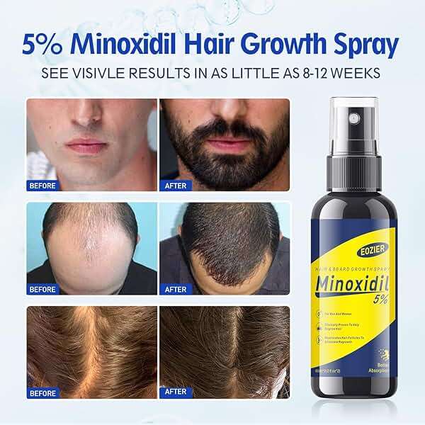 5% Minoxidil with Biotin, Hair Loss Treatments for Women Men Hair Regrowth Treatment, Minoxidil Spray Hair and Beard Mustached Growth Serum Oil, Improves Appearance of Thinning Hair,4 FL OZ/120mL - Image 3
