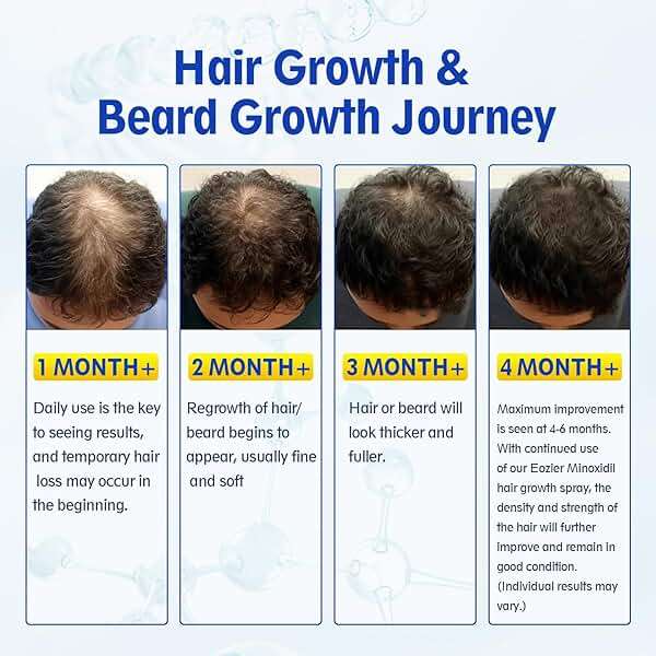 5% Minoxidil with Biotin, Hair Loss Treatments for Women Men Hair Regrowth Treatment, Minoxidil Spray Hair and Beard Mustached Growth Serum Oil, Improves Appearance of Thinning Hair,4 FL OZ/120mL - Image 9