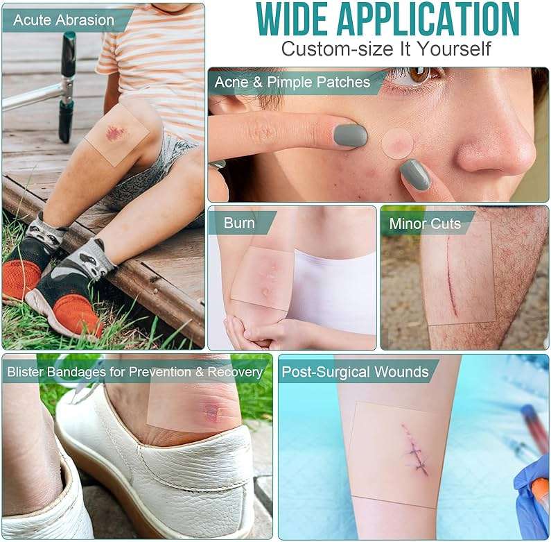 40 Pack Hydrocolloid Wound Dressing 4" x 4", Hydrocolloid Patch Bandages with Self-Adhesive, Bed Sore Bandages, Highly Absorbent for Burn, Blister, Acne Care, Sterile and Waterproof - Image 4