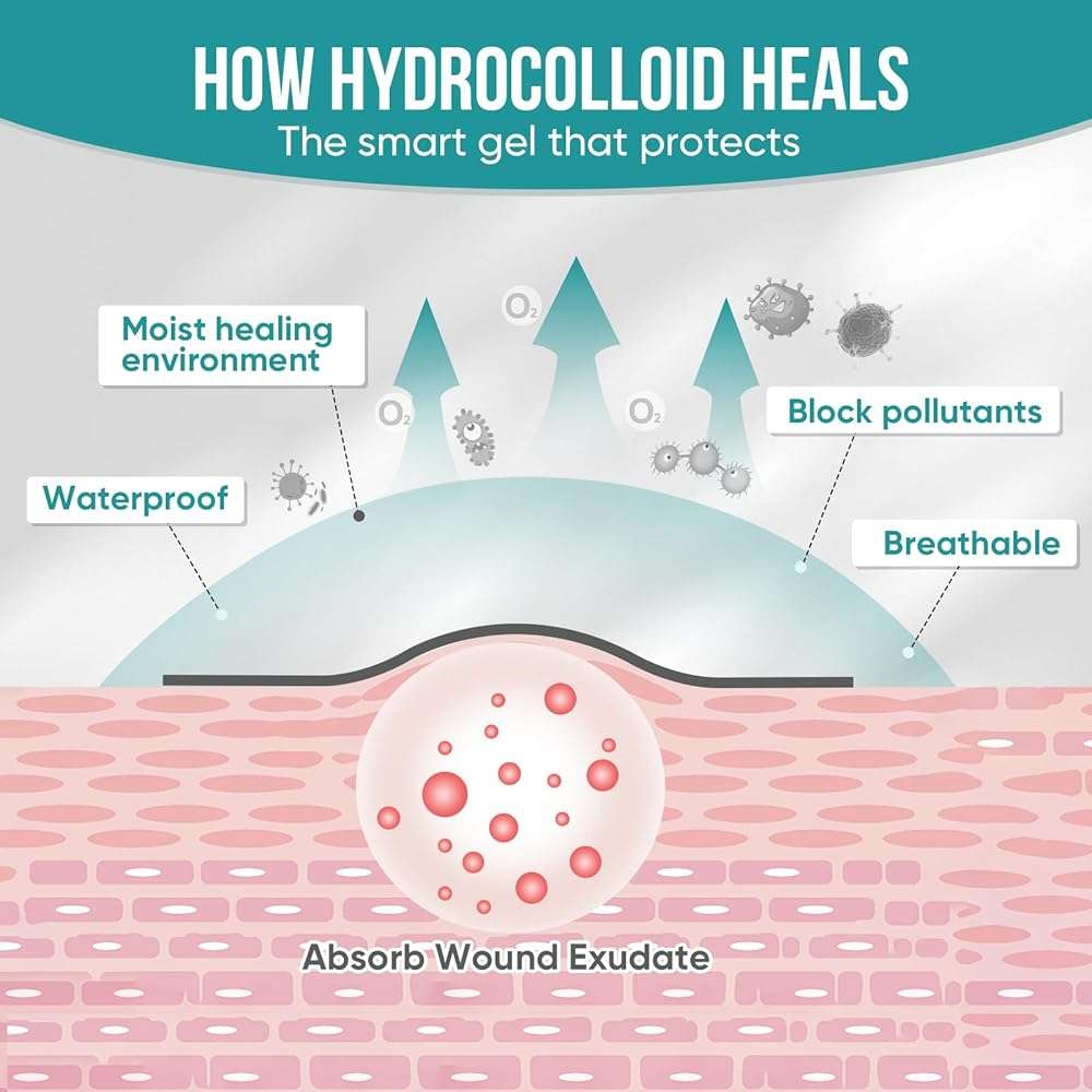 40 Pack Hydrocolloid Wound Dressing 4" x 4", Hydrocolloid Patch Bandages with Self-Adhesive, Bed Sore Bandages, Highly Absorbent for Burn, Blister, Acne Care, Sterile and Waterproof - Image 7