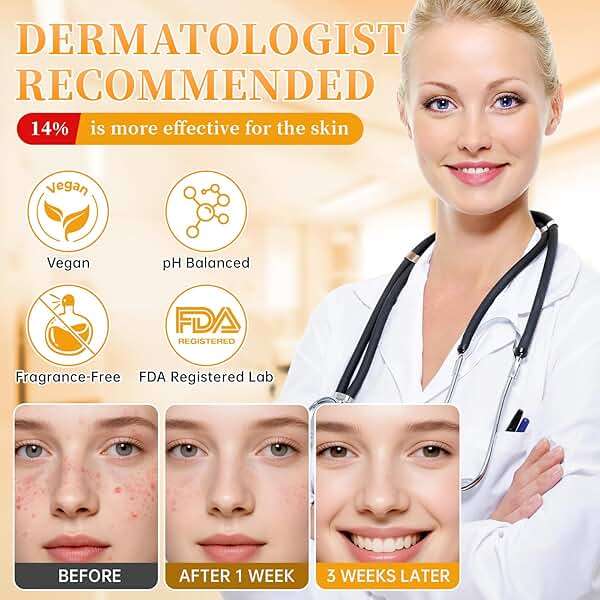 CHANGARLOAD Daily Azelaic Acid Facial Cream, Oil Control & Mild Skin Care, 1oz - Image 3