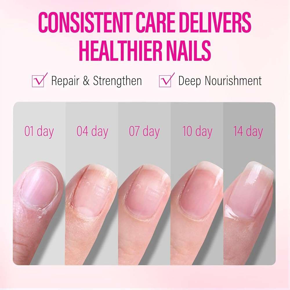 CHUCHU Cuticle Repair Cream for Nail Lovers: Natural Nail Strengthener with Botanicals - Fast Absorbing Treatment for Dry Cracked Cuticles Hangnails & Gel Manicure 15g - Image 5