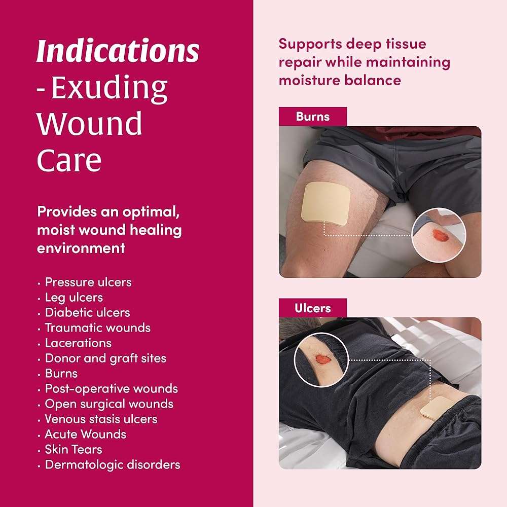 MEDIFOAM - Hydrophilic Foam Dressing, Non-Adhesive, Foam Dressing for High exudate Wounds, 4in x 4in (10sheets) - Image 5