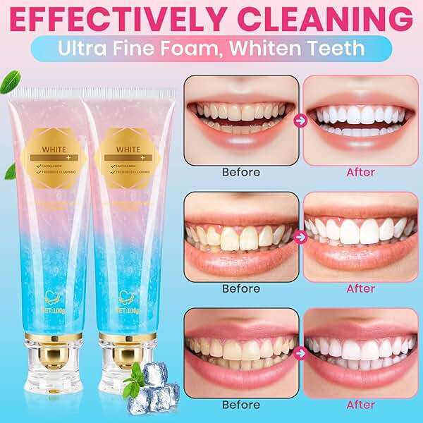 2Pcs Niacinamide Whitening Toothpaste Radiant Whitening Toothpaste, Niacinamide Intensive White Toothpastes, Nicotinamide White Toothpastes, Deep Cleaning Care - Image 2