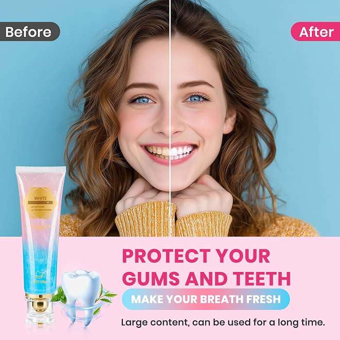 2Pcs Niacinamide Whitening Toothpaste Radiant Whitening Toothpaste, Niacinamide Intensive White Toothpastes, Nicotinamide White Toothpastes, Deep Cleaning Care - Image 4