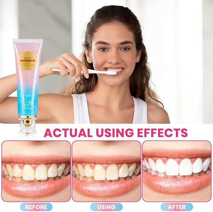2Pcs Niacinamide Whitening Toothpaste Radiant Whitening Toothpaste, Niacinamide Intensive White Toothpastes, Nicotinamide White Toothpastes, Deep Cleaning Care - Image 5