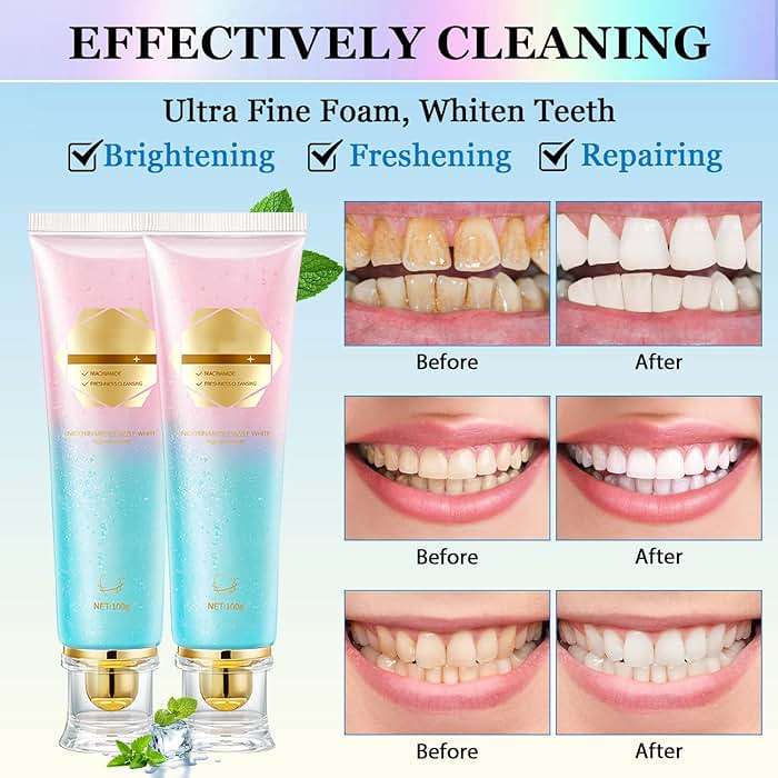 2Pcs Niacinamide Whitening Toothpaste Acssart Radiant White Toothpaste,Niacinamide Intensive Whitening Toothpastes,Nicotinamide Radiant Whiten Toothpastes - Image 2