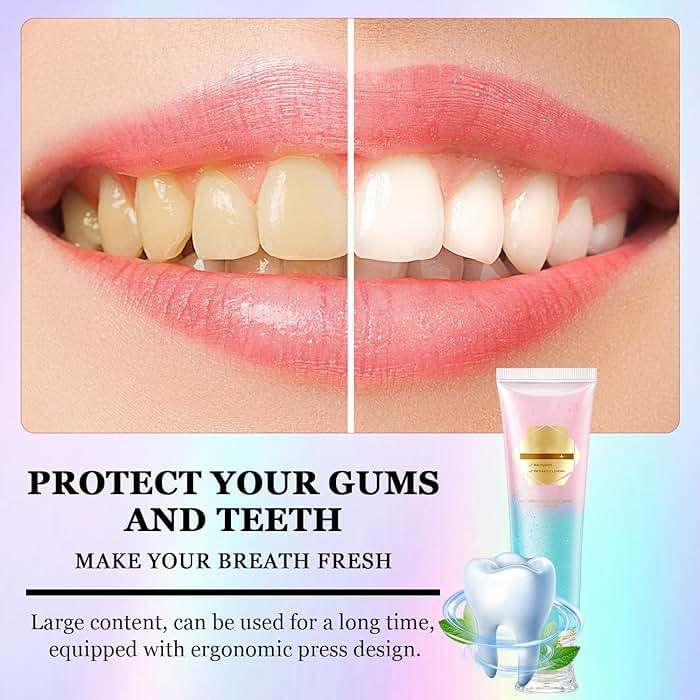 2Pcs Niacinamide Whitening Toothpaste Acssart Radiant White Toothpaste,Niacinamide Intensive Whitening Toothpastes,Nicotinamide Radiant Whiten Toothpastes - Image 5