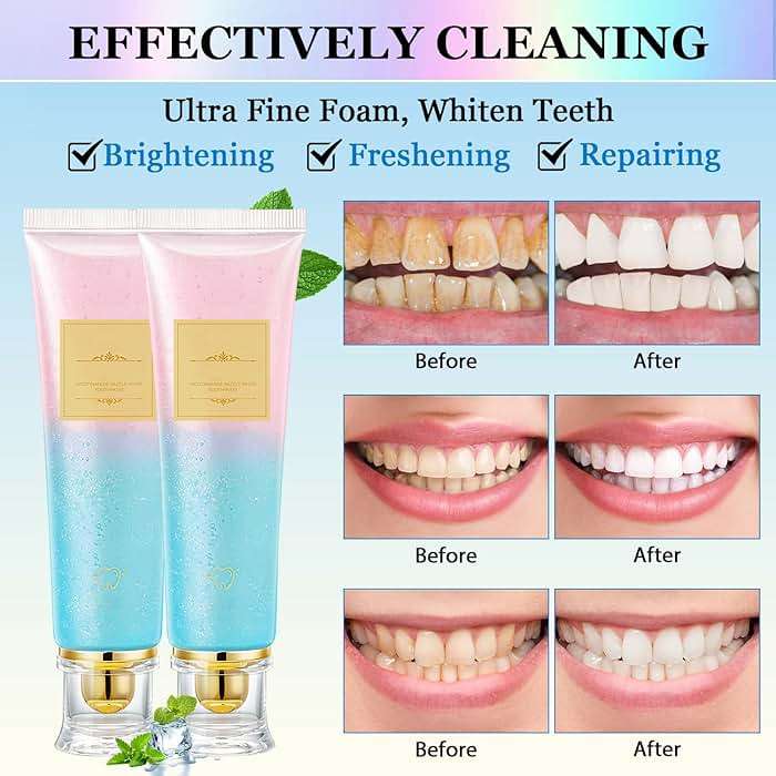 2Pcs Acssart Radiant Whitening Toothpaste,Niacinamide Whitening Toothpaste,Easilyous Bright Whiteing toothpastes,Nicotinamide Dazzling White,Removal Tooth Stains,Fresh Breath - Image 5
