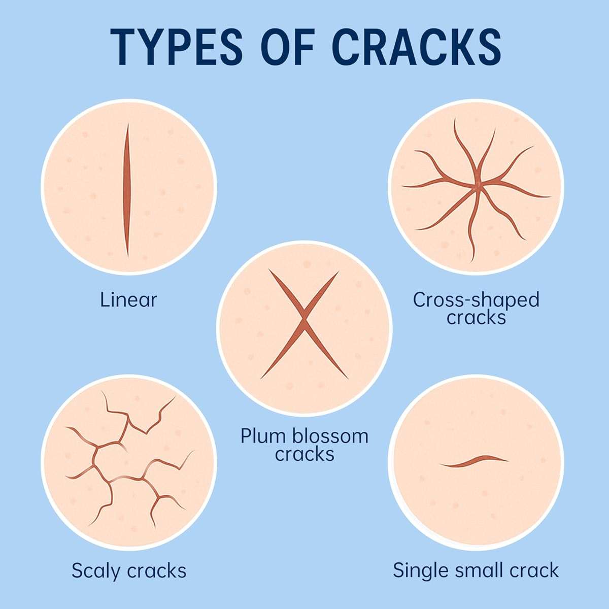 PUREEASE Moisturizing Crack Patches –for Linear, Single Small Crack,for Dry,Cracked Heels,Soles, Toes Skin Relief, Hydrating Care – Flexible & Breathable, 6 Patches - Image 4