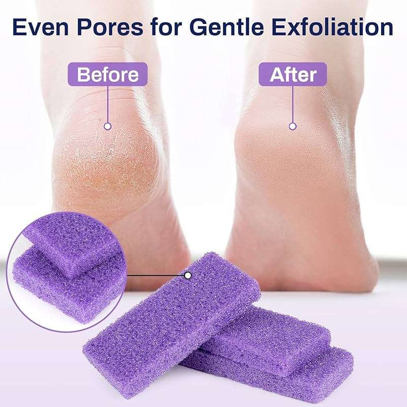 RAQEHO 20 Small Pumice Stone for Feet - 3.6 X 1.8 X 0.47 Inch Purple Foot Pumice Stone Foot Filer Pedicura Scrubber for Callus Removal Foot Care Spa Productos for Dark Elbows Hard Skin Exfoliating - Image 5