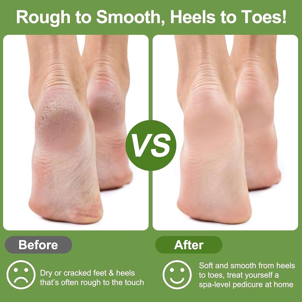 Pumice Stone for Feet, 3 Pack Natural Earth Lava Foot Callus Remover & Pedicure Exfoliator Tools for Heels, Soles and Toe Gaps, Foot Scrubber for Dry & Dead Skin - Image 4