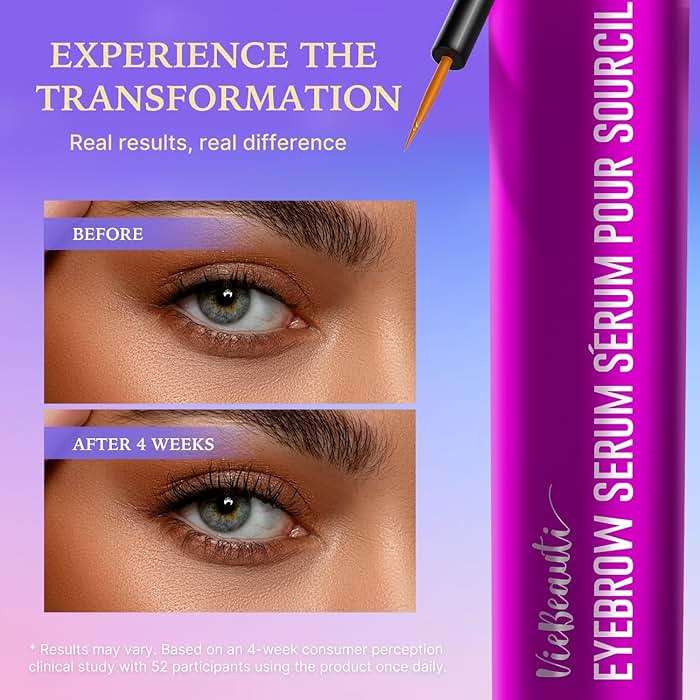 VieBeauti Lash Serum for Eyelash Growth, Prostaglandin Free EyeLash Serum with Peptides for Longer Fuller Thicker Looking Lashes, Vegan & Cruelty-Free, Safe for Sensitive Eyes, 3mL - Image 2